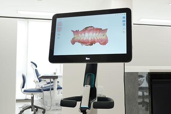 口腔内スキャナー