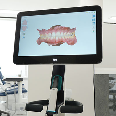 口腔内スキャナー